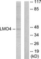 LMO4 Antibody - Western blot analysis of lysates from 293 cells, using LMO4 Antibody. The lane on the right is blocked with the synthesized peptide.