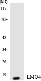 LMO4 Antibody - Western blot analysis of the lysates from HepG2 cells using LMO4 antibody.