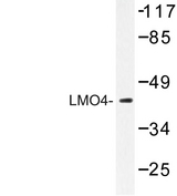 LMO4 Antibody - Western blot of LMO4 (E138) pAb in extracts from 293 cells.