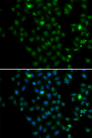 LMO4 Antibody - Immunofluorescence analysis of MCF7 cell using LMO4 antibody. Blue: DAPI for nuclear staining.
