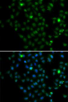 LMO4 Antibody - Immunofluorescence analysis of MCF7 cell using LMO4 antibody. Blue: DAPI for nuclear staining.