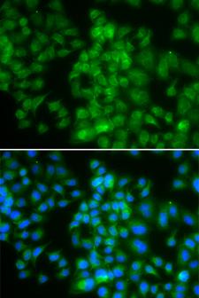 LMO4 Antibody - Immunofluorescence analysis of HeLa cell using LMO4 antibody. Blue: DAPI for nuclear staining.