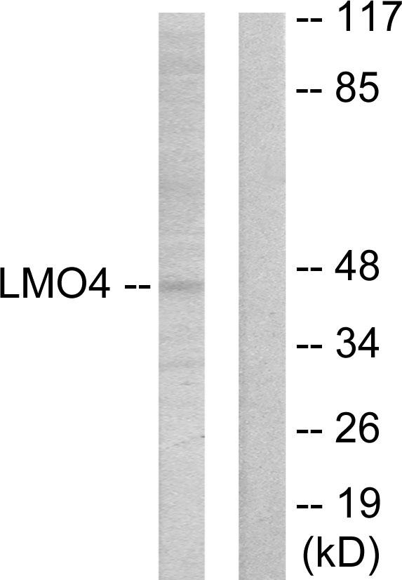 LMO4 Antibody - Western blot analysis of extracts from 293 cells, using LMO4 antibody.