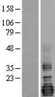 LMO4 Protein - Western validation with an anti-DDK antibody * L: Control HEK293 lysate R: Over-expression lysate