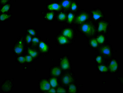 LMO7 Antibody - Immunofluorescence staining of Hela cells diluted at 1:66, counter-stained with DAPI. The cells were fixed in 4% formaldehyde, permeabilized using 0.2% Triton X-100 and blocked in 10% normal Goat Serum. The cells were then incubated with the antibody overnight at 4°C.The Secondary antibody was Alexa Fluor 488-congugated AffiniPure Goat Anti-Rabbit IgG (H+L).