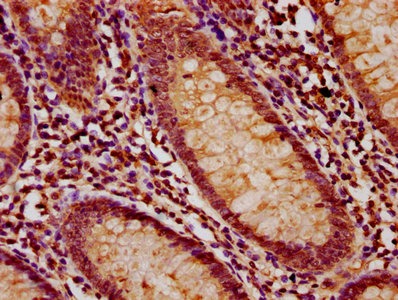 LMO7 Antibody - Immunohistochemistry Dilution at 1:200 and staining in paraffin-embedded human appendix tissue performed on a Leica BondTM system. After dewaxing and hydration, antigen retrieval was mediated by high pressure in a citrate buffer (pH 6.0). Section was blocked with 10% normal Goat serum 30min at RT. Then primary antibody (1% BSA) was incubated at 4°C overnight. The primary is detected by a biotinylated Secondary antibody and visualized using an HRP conjugated SP system.