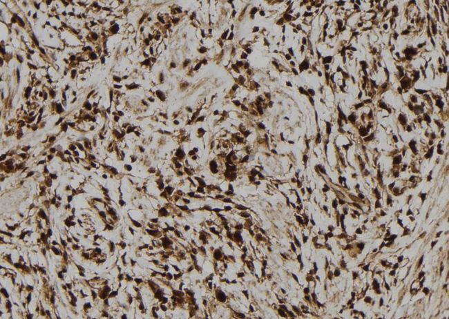 LMO7 Antibody - 1:100 staining human gastric tissue by IHC-P. The sample was formaldehyde fixed and a heat mediated antigen retrieval step in citrate buffer was performed. The sample was then blocked and incubated with the antibody for 1.5 hours at 22°C. An HRP conjugated goat anti-rabbit antibody was used as the secondary.