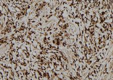 LMO7 Antibody - 1:100 staining human gastric tissue by IHC-P. The sample was formaldehyde fixed and a heat mediated antigen retrieval step in citrate buffer was performed. The sample was then blocked and incubated with the antibody for 1.5 hours at 22°C. An HRP conjugated goat anti-rabbit antibody was used as the secondary.