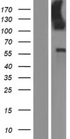 LMO7 Protein - Western validation with an anti-DDK antibody * L: Control HEK293 lysate R: Over-expression lysate
