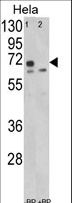 LMOD1 Antibody - Western blot of LMOD1 Antibody (Center N201) in HeLa cell line lysates (35 ug/lane). LMOD1 (arrow) was detected using the purified antibody.