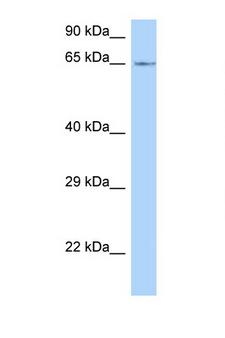 LMOD1 Antibody - LMOD1 antibody Western blot of Mouse Thymus lysate. Antibody concentration 1 ug/ml.  This image was taken for the unconjugated form of this product. Other forms have not been tested.