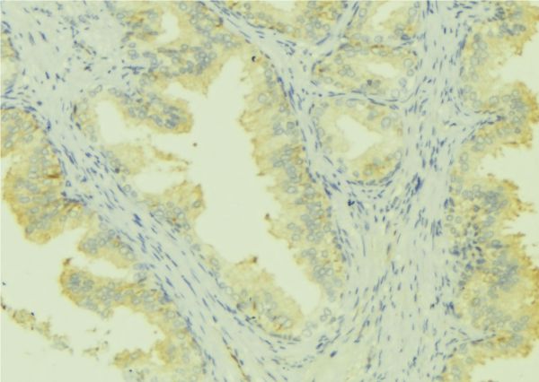 LMOD1 Antibody - 1:100 staining mouse colon tissue by IHC-P. The sample was formaldehyde fixed and a heat mediated antigen retrieval step in citrate buffer was performed. The sample was then blocked and incubated with the antibody for 1.5 hours at 22°C. An HRP conjugated goat anti-rabbit antibody was used as the secondary.