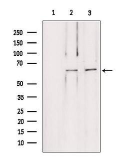 LMOD1 Antibody - Western blot analysis of extracts of various samples using LMOD1 antibody. Lane 1: mouse Myeloma cells treated with blocking peptide. Lane 2: mouse Myeloma cells; Lane 3: HepG2;