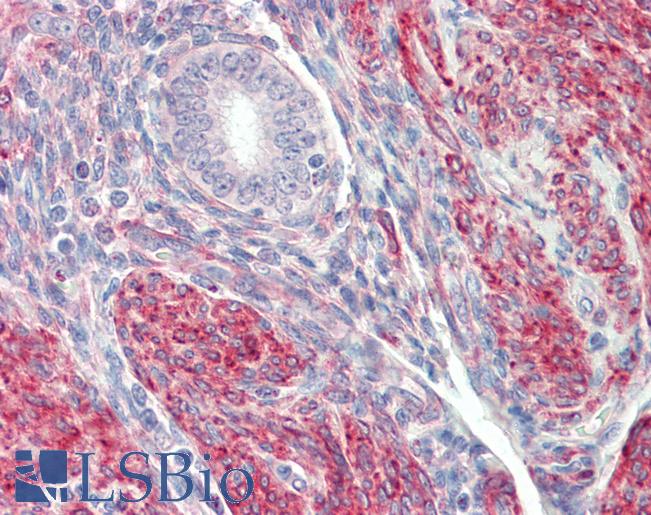 LMOD1 Antibody - Anti-LMOD1 antibody IHC staining of human uterus. Immunohistochemistry of formalin-fixed, paraffin-embedded tissue after heat-induced antigen retrieval. Antibody concentration 5 ug/ml.  This image was taken for the unconjugated form of this product. Other forms have not been tested.