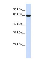 LMOD1 Antibody - Placenta lysate. Antibody concentration: 1.0 ug/ml. Gel concentration: 12%.  This image was taken for the unconjugated form of this product. Other forms have not been tested.