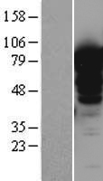 LMOD1 Protein - Western validation with an anti-DDK antibody * L: Control HEK293 lysate R: Over-expression lysate