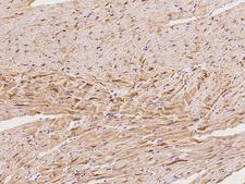 LMOD2 Antibody - Immunochemical staining of human LMOD2 in cynomolgus heart with rabbit polyclonal antibody at 1:100 dilution, formalin-fixed paraffin embedded sections.