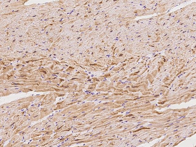 LMOD2 Antibody - Immunochemical staining of human LMOD2 in cynomolgus heart with rabbit polyclonal antibody at 1:100 dilution, formalin-fixed paraffin embedded sections.