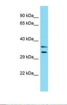 LMOD3 Antibody - Western blot of Human HCT15. LMOD3 antibody dilution 1.0 ug/ml.  This image was taken for the unconjugated form of this product. Other forms have not been tested.