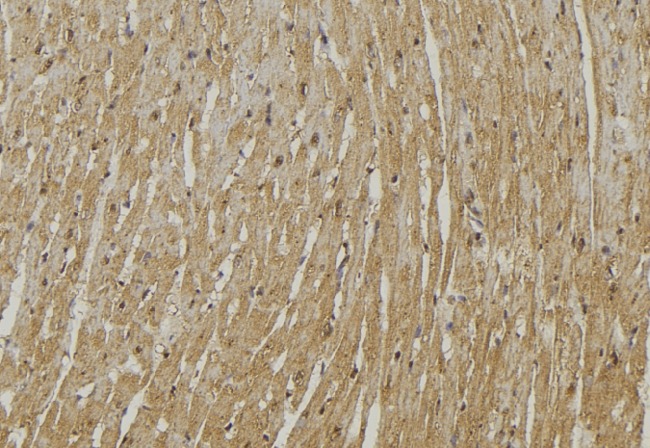 LMOD3 Antibody - 1:100 staining mouse muscle tissue by IHC-P. The sample was formaldehyde fixed and a heat mediated antigen retrieval step in citrate buffer was performed. The sample was then blocked and incubated with the antibody for 1.5 hours at 22°C. An HRP conjugated goat anti-rabbit antibody was used as the secondary.
