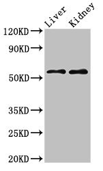 LMP2 Antibody - Western Blot Positive WB detected in:Mouse liver tissue,Mouse kidney tissue All Lanes:LMP2 antibody at 2µg/ml Secondary Goat polyclonal to rabbit IgG at 1/50000 dilution Predicted band size: 54,41 KDa Observed band size: 54 KDa