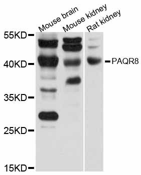 LMPB1 / PAQR8 Antibody - Western blot analysis of extracts of various cell lines, using PAQR8 antibody at 1:1000 dilution. The secondary antibody used was an HRP Goat Anti-Rabbit IgG (H+L) at 1:10000 dilution. Lysates were loaded 25ug per lane and 3% nonfat dry milk in TBST was used for blocking. An ECL Kit was used for detection and the exposure time was 10s.