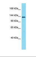 LMTK3 Antibody - Western blot of Mouse Pancreas. Lmtk3 antibody dilution 1.0 ug/ml.  This image was taken for the unconjugated form of this product. Other forms have not been tested.