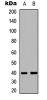 LMTK3 Antibody - Western blot analysis of LMTK3 expression in SHSY5Y (A); NIH3T3 (B) whole cell lysates.