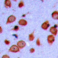LMTK3 Antibody - Immunohistochemical analysis of LMTK3 staining in human brain formalin fixed paraffin embedded tissue section. The section was pre-treated using heat mediated antigen retrieval with sodium citrate buffer (pH 6.0). The section was then incubated with the antibody at room temperature and detected using an HRP conjugated compact polymer system. DAB was used as the chromogen. The section was then counterstained with hematoxylin and mounted with DPX.