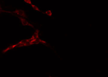 LMTK3 Antibody - Staining 293 cells by IF/ICC. The samples were fixed with PFA and permeabilized in 0.1% Triton X-100, then blocked in 10% serum for 45 min at 25°C. The primary antibody was diluted at 1:200 and incubated with the sample for 1 hour at 37°C. An Alexa Fluor 594 conjugated goat anti-rabbit IgG (H+L) Ab, diluted at 1/600, was used as the secondary antibody.