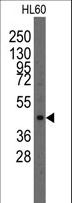 LMX1A Antibody - Western blot of anti-Lmx1a antibody in HL60 cell line lysates (35 ug/lane). Lmx1a(arrow) was detected using the purified antibody.