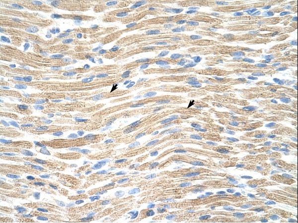 LMX1A Antibody - LMX1A antibody ARP31999_T100-NP_796372-LMX1A (LIM homeobox transcription factor 1, alpha) Antibody was used in IHC to stain formalin-fixed, paraffin-embedded human muscle.  This image was taken for the unconjugated form of this product. Other forms have not been tested.