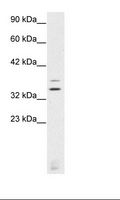 LMX1A Antibody - Jurkat Cell Lysate.  This image was taken for the unconjugated form of this product. Other forms have not been tested.