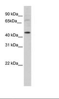 LMX1A Antibody - SP2/0 Cell Lysate.  This image was taken for the unconjugated form of this product. Other forms have not been tested.