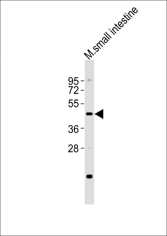 LMX1A Antibody - Anti-LMX1A Antibody at 1:2000 dilution + mouse small intestine lysates Lysates/proteins at 20 ug per lane. Secondary Goat Anti-Rabbit IgG, (H+L), Peroxidase conjugated at 1/10000 dilution Predicted band size : 43 kDa Blocking/Dilution buffer: 5% NFDM/TBST.