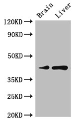 LMX1A Antibody - Positive WB detected in:Rat brain tissue,Rat liver tissue;All lanes:LMX1A antibody at 3?g/ml;Secondary;Goat polyclonal to rabbit IgG at 1/50000 dilution;Predicted band size: 43,15 KDa;Observed band size: 43 KDa;