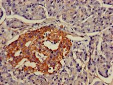 LMX1A Antibody - Immunohistochemistry of paraffin-embedded human pancreatic tissue using LMX1A Antibody at dilution of 1:100