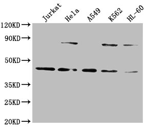 LMX1A Antibody - Western Blot Positive WB detected in: Jurkat whole cell lysate, Hela whole cell lysate, A549 whole cell lysate, K562 whole cell lysate, HL60 whole cell lysate All lanes: LMX1A antibody at 1:2000 Secondary Goat polyclonal to rabbit IgG at 1/50000 dilution Predicted band size: 43, 15 kDa Observed band size: 43 kDa