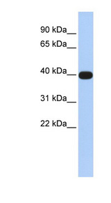 LMX1A Antibody - LMX1A antibody Western blot of Fetal Brain lysate. This image was taken for the unconjugated form of this product. Other forms have not been tested.