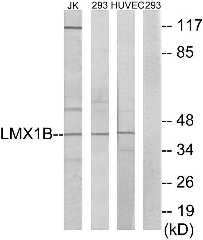 LMX1B Antibody - Western blot analysis of lysates from Jurkat, 293, and HUVEC cells, using LMX1B Antibody. The lane on the right is blocked with the synthesized peptide.