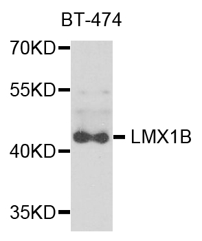 LMX1B Antibody - Western blot analysis of extracts of BT-474 cells.