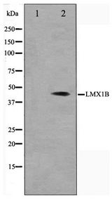 LMX1B Antibody - Western blot of Jurkat cell lysate using LMX1B Antibody