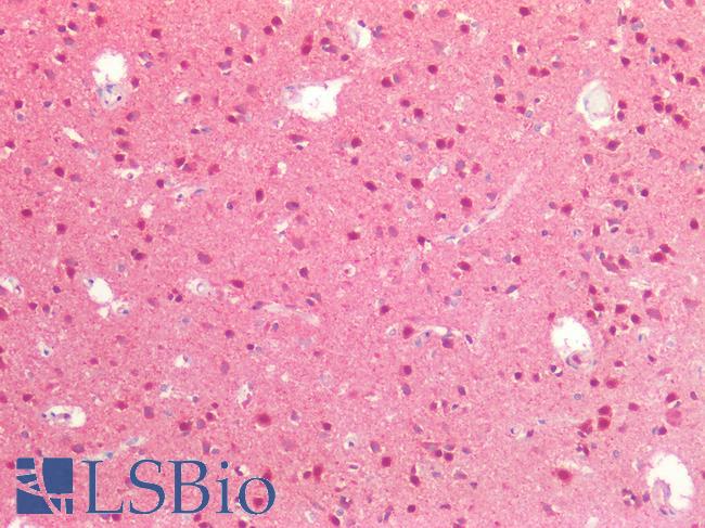 LMX1B Antibody - Human Brain, Cortex: Formalin-Fixed, Paraffin-Embedded (FFPE)