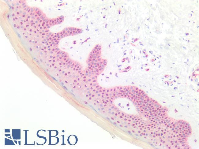 LMX1B Antibody - Human Skin: Formalin-Fixed, Paraffin-Embedded (FFPE)