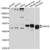 LMX1B Antibody - Western blot analysis of extracts of various cell lines, using LMX1B antibody at 1:1000 dilution. The secondary antibody used was an HRP Goat Anti-Rabbit IgG (H+L) at 1:10000 dilution. Lysates were loaded 25ug per lane and 3% nonfat dry milk in TBST was used for blocking. An ECL Kit was used for detection and the exposure time was 30s.