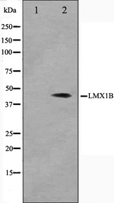 LMX1B Antibody - Western blot analysis on Jurkat cell lysates using LMX1B antibody. The lane on the left is treated with the antigen-specific peptide.