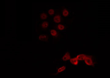 LMX1B Antibody - Staining HeLa cells by IF/ICC. The samples were fixed with PFA and permeabilized in 0.1% Triton X-100, then blocked in 10% serum for 45 min at 25°C. The primary antibody was diluted at 1:200 and incubated with the sample for 1 hour at 37°C. An Alexa Fluor 594 conjugated goat anti-rabbit IgG (H+L) Ab, diluted at 1/600, was used as the secondary antibody.