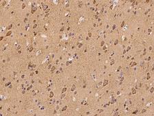 LMX1B Antibody - Immunochemical staining of human LMX1B in human brain with rabbit polyclonal antibody at 1:100 dilution, formalin-fixed paraffin embedded sections.