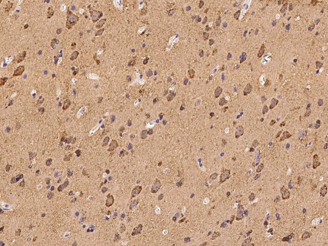 LMX1B Antibody - Immunochemical staining of human LMX1B in human brain with rabbit polyclonal antibody at 1:100 dilution, formalin-fixed paraffin embedded sections.