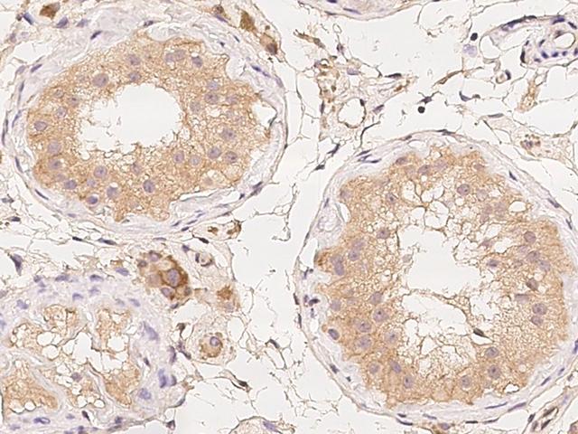 LMX1B Antibody - Immunochemical staining of human LMX1B in human testis with rabbit polyclonal antibody at 1:100 dilution, formalin-fixed paraffin embedded sections.